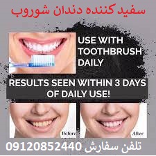 قیمت خرید سفید کننده دندان شوروب در شهر کلات